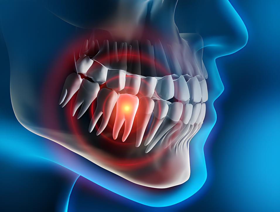 Teeth image - Emergency dentist Basildon